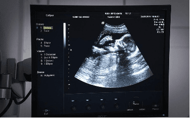 BEIRUT - OBGYN